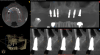 Fig 12. CBCT of final implant placement with
cross-section of maxillary left side sinus elevation.