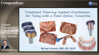 Treatment Planning Implant Overdentures for Today with a Fixed Option Tomorrow Webinar Thumbnail