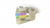 Fig 1. Sequencing selective anesthesia (PSA = posterior superior alveolar, IAN = inferior alveolar nerve).