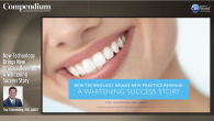 New Technology Brings New Practice Revenue: A Whitening Success Story Webinar Thumbnail