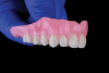 Fig 8. Denture teeth fixed to 3D-printed base.