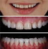 Fig 8. Intraoral views after orthodontic treatment.