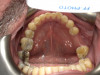 Fig 4. Extra-oral photography. All dental practices should provide the patient with the following four extra-oral photographs: the close-up smile (Fig 1), the retracted smile (Fig 2), the upper arch (Fig 3), and the lower arch (Fig 4).