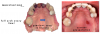 Fig 5. Completing full arch scans regardless of workflows allows the possibility to utilize data in different ways in the future. Left panel: patient’s previous scan in digital library. Right panel: patient’s current presentation.