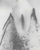 Fig 1. Photomicrographs illustrating vascular supply to the periodontium and supportive alveolar bone. Fig 1 shows the presence of a vascular network within the periosteum on the buccal aspect of the alveolar bone and within the cancellous aspect of the alveolar bone. Fig 2 demonstrates the vascular blood supply found within the PDL space adjacent to a tooth that has been sectioned in a buccolingual dimension. The blood supply to the cancellous bone and periosteum is also demonstrated in this section. (Images republished with permission of C.V. Mosby Co., from Keller GJ, Cohen DW. Oral Surg Oral Med Oral Pathol. 1955;8(5):539-542. Permission conveyed through Copyright Clearance Center, Inc.)