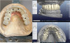 Fig 11. Digital planning of final prosthesis.