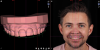 Fig 2. Digital smile design planning.