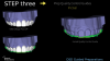 Fig 13. Incisal preparation quality control plan.