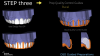 Fig 15. Buccal preparation quality control plan.