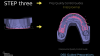 Fig 17. Inter­proximal preparation quality control plan.