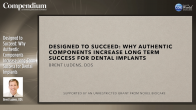 Designed to Succeed: Why Authentic Components Increase Long-Term Success for Dental Implants Webinar Thumbnail