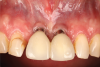 Fig 1. Clinical view at presentation.