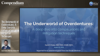 The Underworld of Overdentures: A Deep Dive into Complications and Mitigation Techniques Webinar Thumbnail
