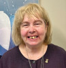 Fig 23. Case 3: Initial presentation for maxillary and mandibular immediate implant, immediate load provisional restorations. Full-face photograph.