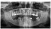 Fig 24. Initial panoramic radiograph.