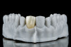 Fig 10. A two-step zirconia polishing sequence is used, with step 1 used before stain/glaze application.