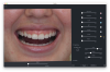 Fig 2. Patient’s condition at presentation. Note small teeth size and uneven condition of anterior incisal edges.