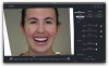 Fig 4. Version one of the smile design, with only flowable composite veneers.