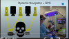 Fig 1. A tracking device is attached to the patient and the handpiece. The light from the camera hits the tracking device, capturing the relation of the handpiece to the patient and providing real-time feedback to the surgeon. In this way, dynamic navigation is in some ways similar to the GPS device we use in automobiles.