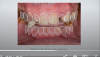 Fig 27. Digital smile design, intraoral view.