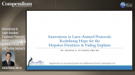 Innovations in Laser-Assisted Treatment Protocols: Redefining Hope for Hopeless Dentition and Failing Implants Webinar Thumbnail