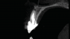 Fig 3. Initial diagnostic CBCT.