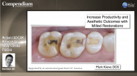 Modern CAD/CAM Materials for Today’s Dental Practice Webinar Thumbnail