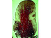 Fig 3. Gingival biopsy from a site that did not bleed upon probing. Note there is no inflammatory infiltrate and the collagen (reddish area) is intact. (Fig 2 and Fig 3 are courtesy of Jack Caton, DDS.)