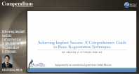 Achieving Implant Success: Comprehensive Guide to Bone Regeneration Techniques Webinar Thumbnail