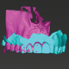 Fig 7: Fusion of CBCT data (shown in magenta) with the IOI (shown in cyan).