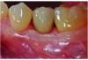 Fig 10. Clinical presentation at 2-month follow-up.