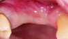 Fig 9: initial presentation;
