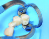 Fig 7. Forceps are used to expand the clamp, enabling the rubber dam sheet to slide underneath the tooth and cover the exposed soft tissues.