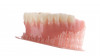 Fig 4. Complete denture printed at 45 degrees.
