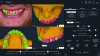 Fig 3. AI applications in orthodontics encompass cephalometric analysis, treatment outcome prediction, and automated treatment planning.