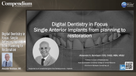 Digital Dentistry in Focus: Single Anterior Implants from Planning to Restoration Webinar Thumbnail
