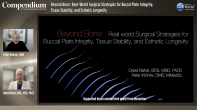 Beyond Bone: Real-World Surgical Strategies for Buccal Plate Integrity, Tissue Stability, and Esthetic Longevity Webinar Thumbnail