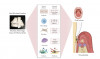 Fig 5. Mechanisms potentially linking oral nicotine pouches
to periodontal disease development and progression. Exposure to constituents of
ONPs (left), which contain nicotine, flavoring agents, trace amounts of TSNAs,
and metals, may alter epithelial, immune, connective tissue, bone, and
microbial responses within the oral cavity (center), which may promote
inflammation, dysbiosis, and bone resorption, ultimately contributing to
periodontitis and other oral lesions (right). (Adapted from Ye D, Rahman I. <em>Int
J Dent</em>. 2023;2023:9437475.<sup>10</sup>)