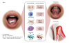 Fig 5. Mechanisms potentially linking oral nicotine pouches
to periodontal disease development and progression. Exposure to constituents of
ONPs (left), which contain nicotine, flavoring agents, trace amounts of TSNAs,
and metals, may alter epithelial, immune, connective tissue, bone, and
microbial responses within the oral cavity (center), which may promote
inflammation, dysbiosis, and bone resorption, ultimately contributing to
periodontitis and other oral lesions (right). (Adapted from Ye D, Rahman I. <em>Int
J Dent</em>. 2023;2023:9437475.<sup>10</sup>)