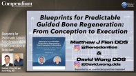 Blueprints for Predictable Guided Bone Regeneration: From Conception to Execution Webinar Thumbnail