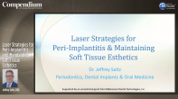 Laser Strategies for Peri-Implantitis and Maintaining Soft Tissue Esthetics Webinar Thumbnail