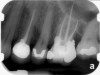 Fig 12. Postoperative radiograph.