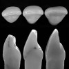 Fig 21. Standard deviation, central incisors.