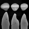 Fig 22. Standard deviation, lateral incisors.