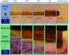 Fig 7. NBTC stain showing effect of cutting speed on collateral thermal damage using regular diode laser.