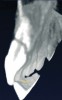 Figure 3d  The 3D capability of the CBCT shows the full extent of the horizontal fracture, as well as the fracture of the buccal and palatal plates.20