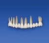 Figure 7a  Pretreatment arrangement of teeth Nos. 3 through 14. Tooth No. 4 is missing. Dotted lines indicate teeth with endodontic therapy.