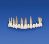 Figure 8a  Pretreatment tooth arrangement.