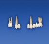 Figure 8b  Teeth Nos. 5, 8, and 9 are extracted.