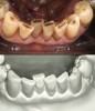 Figure 8   The intraoral photograph confirms and describes intensities of chroma that are not communicated on the stone model.